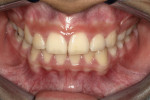 Fig 2. Facial retracted smile view of the patient.