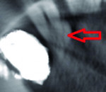 Figure 2. Small volume with streaks.