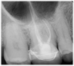 Figure 8. Full-coverage seated radiograph.