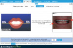 Diagnostic Wizard screen shot identifying deficient incisal edge position in “E” smile.