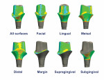 Areas of milled abutments that were 3D analyzed for comparison to STL design files.