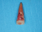 Figure 3  The extracted tooth.