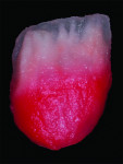 Fig 10. Dentin A2 is applied to the gingival one-half and a mixture of BL2 and A1 is applied to the incisal one-half.
