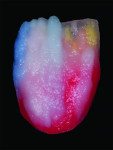 Fig 13. A thin layer of blue translucent was applied on the distal and mesial corners of tooth No. 7 then BL enamel applied to enhance and contrast each layer.