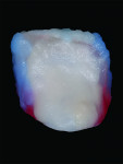 Fig 15. Warm color of mamelon orange-yellow enamel was applied on palatal area of the lingual aspects and lingual marginal ridges built with dentin powders to create a frosty look on the lingual singulum.