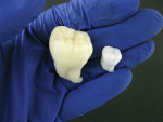 The printed models of the same tooth are sized at 100% and 200%. Larger models provide excellent aides in demonstrating or explaining patient procedures.