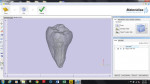 Micro-CT scan data file as viewed using the MiniMagics free viewer (Materialise, www.materialise.com). The internal pulpal areas and canals can be visualized in three dimensions as the tooth scan is rotated with a computer mouse.