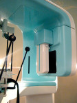 Figure 1  The Asahi Roentgen Alioth seen witha panoramic sensor mounted in front of the CBCTflat panel. This unit was shown at the Asian Congresson Oral and Maxillofacial Radiology, Nara, Japan,November 20-22, 2008.