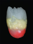 Fig 8. BL2 plus 5% of MM yellow orange are layered on the heights of contour to offset the value, which could be lowered later by subsequent firings.