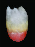 Fig 9. The incisal one-third is covered with D3 dentin.