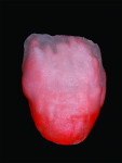 Fig 14. The incisal two-thirds are layered with D2 dentin.
