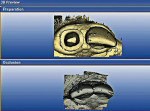 Figure 4  Monitor screen showing data collectionof the preoperative tooth and the prepared tooth.