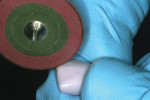 Figure 14  A Perla-Dia coarse diamond wheelwas used to create the developmental grooves.