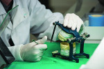 An articulator is used to work on a case.