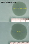 Figure 8  8 Filtek Supreme A-1 exhibited a flow rate percentage increase of 40%; 15 mm diameter after 4 minutes at room temperature (top) and 21 mm diameter after 4 minutes at 150.3°F (bottom).
