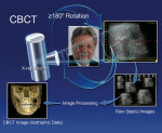 Figure 1  How CBCT works: The large arrows represent the path of the x-ray source and detector around the patient. The smaller arrows represent the subsequent flow of image data and reconstruction of the eventual image for display.