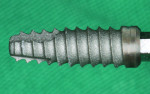 Fig 4. Tapered implant with microchannels and platform switch for bone and soft-tissue stability.