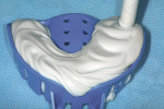 Figure 9: Placement of the tray material in the impression tray.
