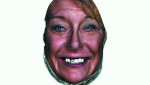 Fig 5. A 3D virtual patient with virtual diagnostic tooth arrangement harmonized with facial features.
