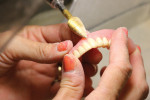 Fig 5. Finishing dentures.