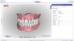 Fig 9. A Digital Design Preview is sent to the
technical customer to preview and manipulate
the 3D PDF of the AvaDent Digital Denture Design.