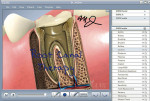 Figure 4  In Guru, the patient signs an image of the module to indicate that they have reviewed the information.