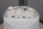 Fig 9. The bridge was then ready to sinter and placed occlusal surface down.