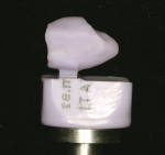 Figure 13  The milled crown still attached to the CAD LT block.