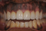 Postoperative photographs of the patient.