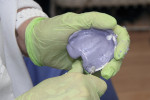 Fig 3. Acrylic bur used to relieve these areas.