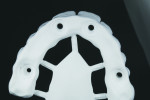Fig 6. Milled zirconia frame with proper support bar.