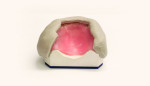 Fig 2. The waxed-up denture is matrixed using silicone.