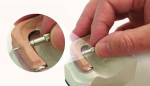 Fig 6. The MK1 acrylic help processing pins are inserted to lock in the supra-structure.