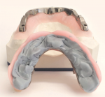 Fig 9. The silicone will facilitate removal when deflasking by preventing any distortions on the 8 supra-structure.