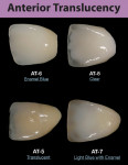 Figure 4  Anterior translucency possibilities were categorized.