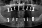 Fig 3. Post-implant placement panoramic radiograph.