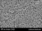 Figure 7  SEM of lithium disilicate (e.max CAD).
