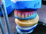 Fig 6. Fabricated matrices for aiding denture teeth placement.