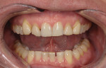 Fig 3. Preoperative retracted view of patient's smile.