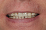 Fig 2. Preoperative smile image.