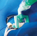 Figure 2  Load the Proximal-Tip with the 15% hydrochloric gel. To apply the Icon-Etch, place the tip between the teeth with the green perforated side facing the carious lesion for precise delivery of the acid-etch. Keep in contact for 2 minutes to re