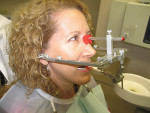 Figure 5  A facebow registration was taken to achieve final restorations that were positioned properly relative to her exact cranium/axis relationship. That position was set on the transfer table, and fixed with a fast-setting plaster. This mounted r