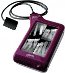 Figure 1  NEW INNOVATION X-pod combines a digital x-ray sensor and touchscreen.