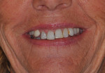 Fig 1. The patient’s smile at presentation.