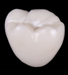 Fig 12. Monolithic molar crown fired at 30°C lower than the ideal temperature determined to develop optimal translucency. Note the significant increased opacity relative to Figure 13.