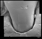 Fig 20. Scanning electron microscopy composite image showing a replica of a tooth restored with a direct-indirect technique. The tooth-restoration transition is virtually imperceptible. (The small fold indentation noted at the top-right side of the image is an artifact.)