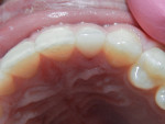 (7.) Photographs at follow up visit: all teeth asymptomatic.