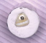 Figure 3  The screw-retained provisional restoration affixed to an analog is immersed in model stone to the height of contour.