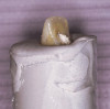 Fig 1. Standard deviation, central incisors.