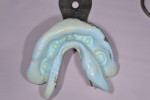 Fig 9. Final impressions of teeth Nos. 19, 22, 24, 25, 27, and 30 using a Rim-Lock mandibular impression tray and Aquasil Ultra Cordless Tissue Managing Impression System.